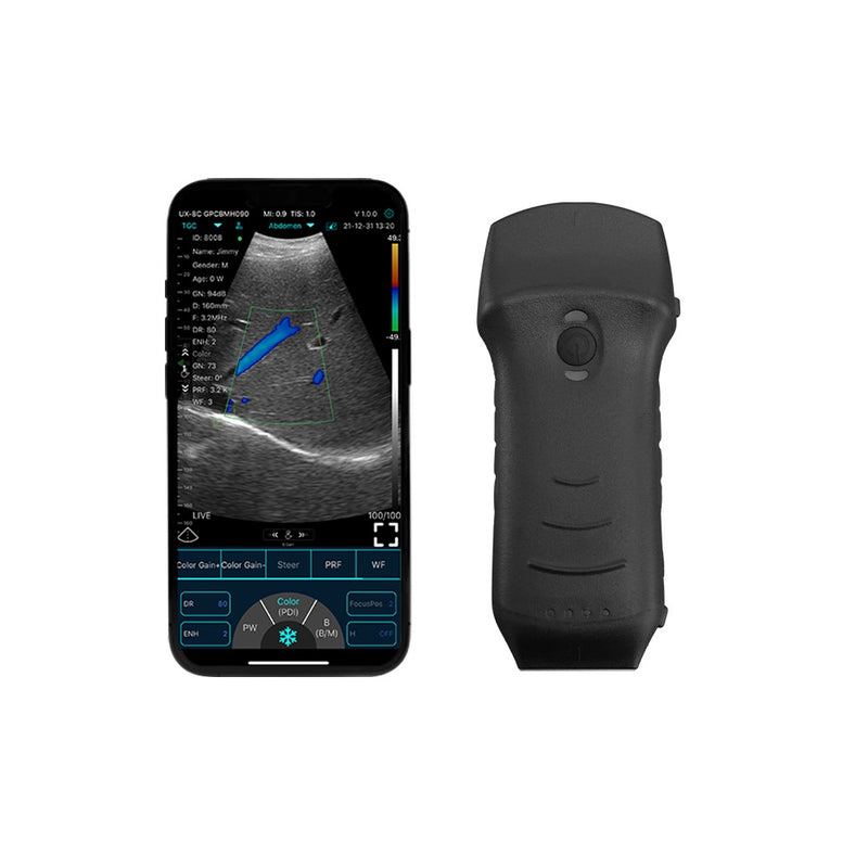 Ultrasonograf bezprzewodowy na telefon 