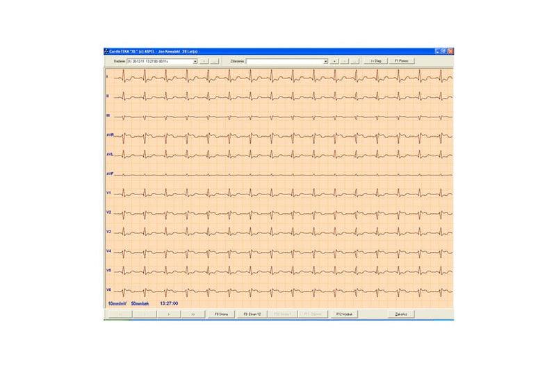 CardioTEKA---oprogramowanie-v.211