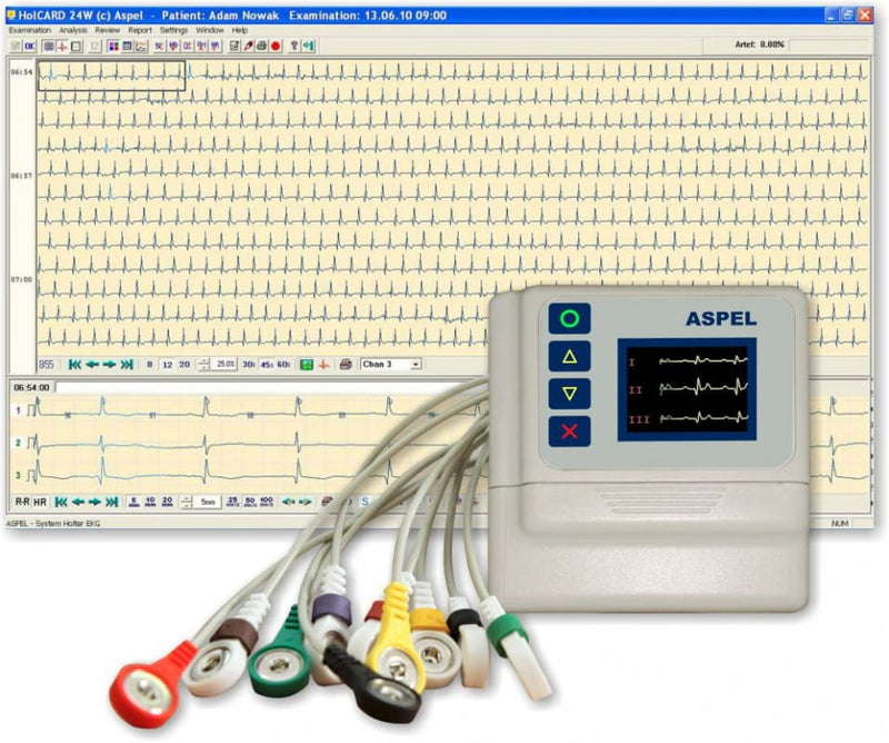 Rejestrator-holterowski-EKG-AsPEKT-712-v.301-(wyświetlacz-OLED)