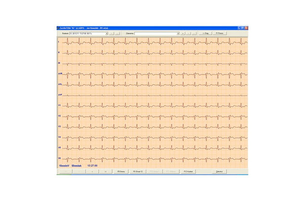 CardioTEKA---oprogramowanie--HL7