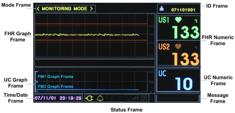 Kardiotokograf-KTG-Bistos-BT-350-LCD