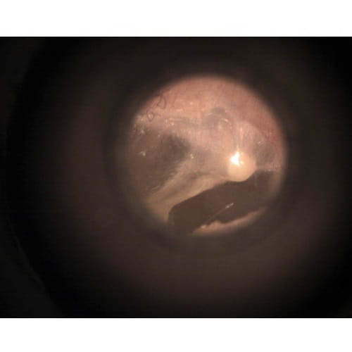 Otoskop---Videootoskop-Welch-Allyn--z-głowicą-Macroview-i-rękojeścią
